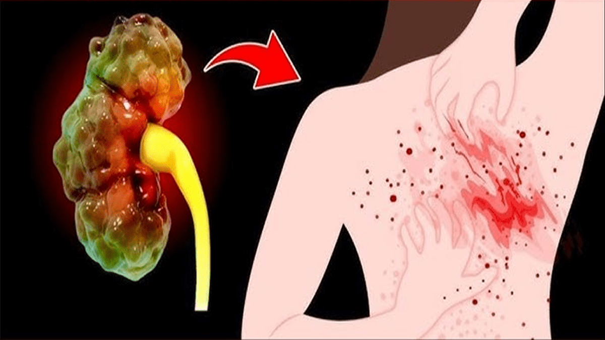 8 Sinais de que Seus Rins Podem Precisar de Atenção — E Por Que Você Não Deve Ignorá-los