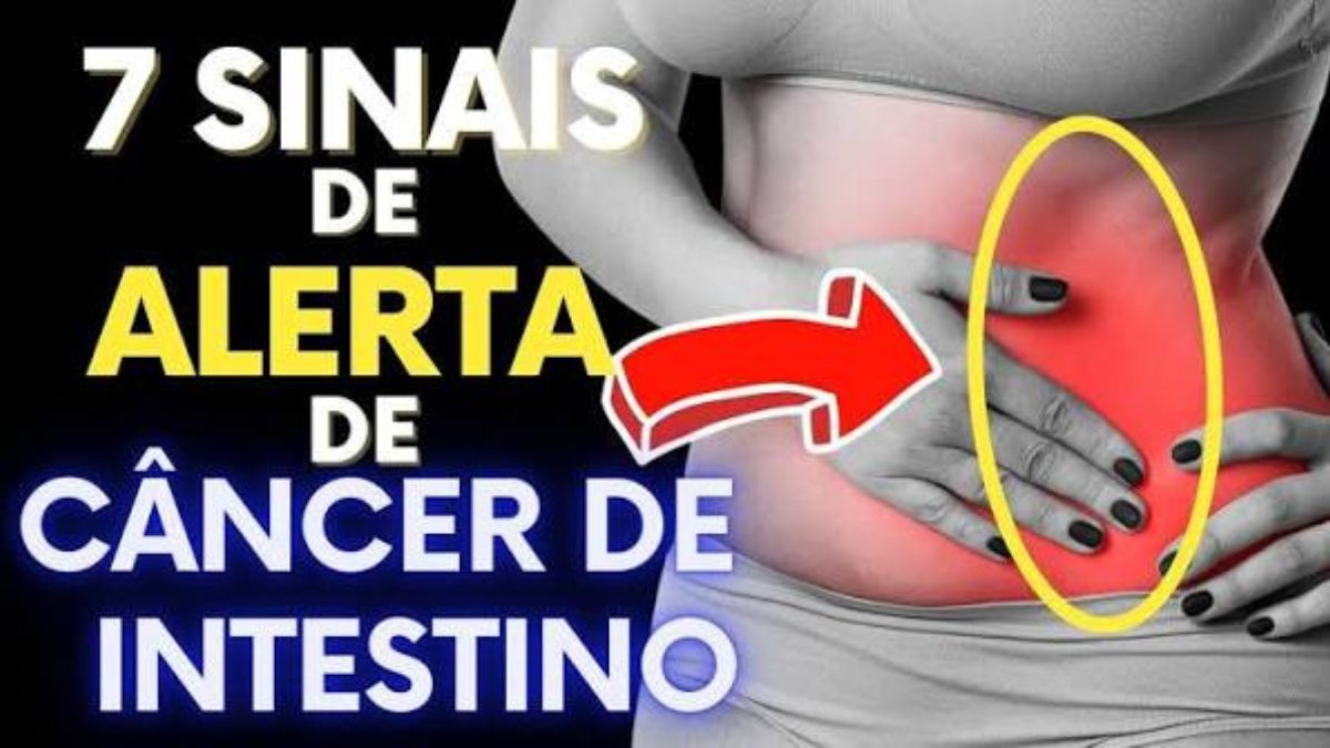 Câncer de Cólon: 7 sinais de alerta que merecem atenção